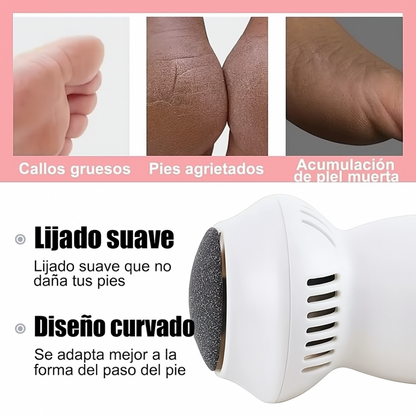 ¡OFERTA DE HOY! QUITA CALLOS PROFESIONAL +ENVIO GRATIS 🏡🚚